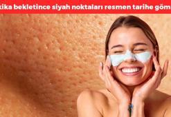 Siyah noktalara 5 dakikada veda edin! Korelilerin cilt bakım sırrı, siyah nokta ve sivilceden eser bırakmıyor, cilt kusurlarının kökünü kurutuyor, resmen C vitamini banyosu yaptırıyor