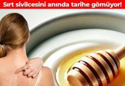 Sırt sivilcelerini 1 günde azaltıyor! Cildinizi sakinleştirip pürüzsüzleştiriyor: 3 malzemeyi karıştırıp uygulayınca etkilerine inanamayacaksınız