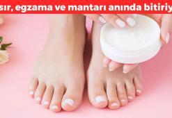 Mantarın kökünü kurutuyor! Nasır, mantar ve egzamayı 1 gecede bitiriyor, doğal antibiyotik anında etki ediyor