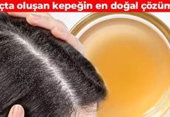 Saçtaki kepeği söküp atıyor! Haftada 1 kez kullanmak yetiyor: Kökleri halat gibi güçlendiriyor, saçları güneş gibi parlatıyor