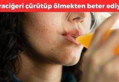 Bardak bardak içiyoruz ama karaciğeri çürütüyor! Tokluk hissini yok edip kilo aldırıyor, ömürden 10 yıl çalıyor!