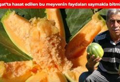 Kilosu 25 TL'den satılıyor! Halk arasında yer muzu olarak da biliniyor: Bağışıklığı güçlendirip kalbi koruyor
