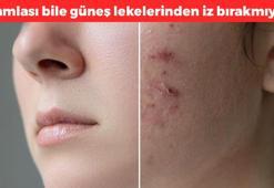 Güneş lekelerini çamaşır suyuyla silmiş gibi yapıyor! 1 damlası bile yetiyor,  bembeyaz bir cildin sırrı meğer oymuş