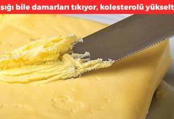 Ayıla bayıla yiyoruz ama zehir saçıyor, kaşık kaşık yiyince ömrü kısaltıyor, kolesterolü tavana çıkarıyor, damarları tıkıyor