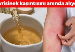 Sinek ısırığı kaşıntısını anında geçiriyor! 1 damla sürmek yetiyor, cildi pamuk gibi yumuşatıp kızarıklığı ve şişliği silip atıyor!