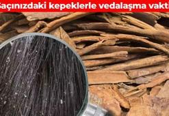 Saç diplerindeki kepeği 15 dakikada bitiriyor! Kaşıntı ve kuruluğu gideren doğal formül: Sağlıklı saçların anahtarı