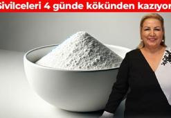 Suna Dumankaya öneriyor! Sivilceleri tek kalemde silen yöntem: 3 malzemeyi karıştırıp 4 gün uygulamak gerekiyor
