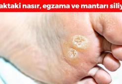 Nasır, egzama ve mantarın kökünü kazıyor! 1 damlası yeterli oluyor, ayakları bebek gibi yumuşacık yapıyor!