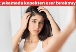 Saçtaki kepekten eser bırakmıyor! Tek yıkamada kepeği yok ediyor, saç derisini iyileştirip canlandırıyor