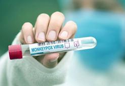 "İstanbul'da bir kişi M çiçeği şüphesiyle karantinaya alındı" iddiasına yalanlama