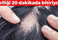 20 dakikada saçkıranın kökünü kazıyor! Egzama, mantar ve sedefi geçiriyor, saçların avuç avuç dökülmesini önlüyor! Kelliğin en kesin ilacı