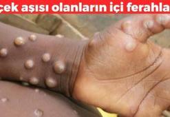 Bir yaş grubunu hiç etkilemiyor! Maymun çiçeği'ne karşı bağışıklıkları var, o gruptansanız çok şanslısınız