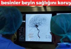 Klinik profesör açıkladı! Beyin sağlığını destekleyen 7 süper besin, tıkalı damarları açıyor, güç oyuncularını her gün tüketin
