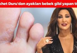 Nükhet Duru'nun ayak bakım tüyosu! Nasırın, mantarın ve topuk çatlaklarının kökünü kurutuyor! 1 hafta uygulamak yetiyor, bebek gibi pürüzsüz ayakların sırrı