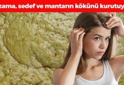 Kelliğe en doğal çare! Tanesi 30 TL: Egzama, sedef ve mantarın kökünü kazıyor, saçın avuç avuç dökülmesini engelliyor!
