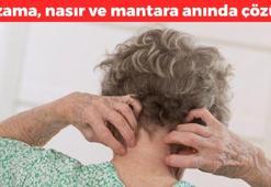 Egzamadan zerre bırakmıyor! Nasır, mantar ve egzamayı anında geçiriyor, cildi tertemiz yapıyor