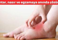 Mantarın kökünü kurutuyor! Nasır, mantar ve egzamaya iyi geliyor, 5 dakikada hazırlanan doğal karışım