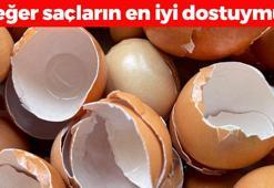 Çöpe atan bin pişman! Saç köklerini coşturup egzama ve kepeğin kökünü kazıyor! Parıl parıl saçların sırrı ondaymış, avuç avuç dökülmeyi engelliyor