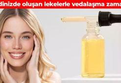Yazdan kalma güneş lekelerini yok ediyor! Cildi ay gibi parlatıyor: Tek bir damlası bile gençleştiriyor, yaşlılık izlerini tek kalemde siliyor, kolajen ürettiriyor