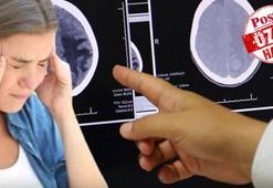 Kulak çınlaması ve baş ağrısıyla kendini gösteriyor! Uzmanı kalıcı hasar ihtimaline dikkat çekti: Alzheimer ve demansı tetikleyebilir