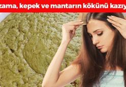 Egzama, mantar ve kepeğin kökünü kazıyor! Hatay'dan dünyaya yayılıyor: Saçı parıl parıl yapıp dökülmeyi engelliyor, sedefi iyileştiriyor!