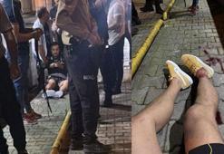 Serhat Akın'ı 250 bin lira karşılığında vurmuşlar! Avukatı detayları Kanal D Haber'e anlattı