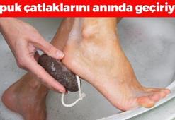 Topuk çatlaklarını anında geçiriyor! Nasırın, mantarın ve kokunun kökünü kazıyor, 5 dakikada ayakları bebek gibi yumuşacık yapıyor!