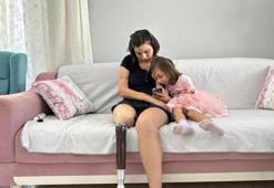 Acılı anneye sıfır diye ikinci el protez bacak sattılar