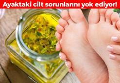 Ayak mantarı kremlerini çöpe attırıyor! Gece sürüp bekletmeniz yetiyor: Mantarın kökünü kurutuyor, nasırı bitiriyor, ayakları yumuşacık yapıyor