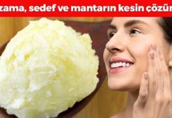 Egzama, mantar ve sedefin kökünü kazıyor! Cildi nemlendirip 10 yaş birden gençleştiriyor, kuruluğa ve kızarıklara son veriyor!