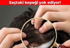 Kepeği 15 dakikada yok ediyor! Mantar ve bakterilerin kökünü kazıyor: Kafa derisini besleyen karışım