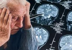Alzheimer tedavisinde dönüm noktası! Yeni etken madde keşfedildi