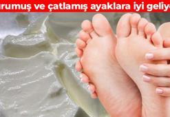 Yumuşak ve bakımlı ayaklar için etkili çözüm! Doğal ayak maskesi: Kuru ve çatlamış topuğa iyi geliyor