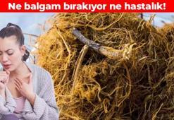 Ciğerdeki balgamı söküyor! Balla karıştırıp için: Solunum yolu enfeksiyonunun kökünü kazıyor, mide asidini dengeliyor