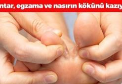 Nasırın kökünü kurutuyor! Egzama, nasır ve mantarı tarihe gömüyor, ayakları pamuk gibi yumuşacık ve pürüzsüz yapıyor!