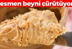 1 lokması bile beyni çürütüyor, ömrümüzden 10 yıl çalıyor! Sağlıklı diye kaşık kaşık yiyoruz ama damar tıkanıklıklarının ve diyabetin en büyük sebebiymiş