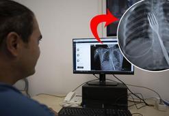 Doktorları bile şoke etti! ‘Böylesiyle daha önce karşılaşmadım’