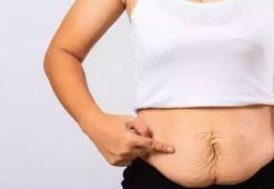 Deri sarkması tedavi edilebilir!