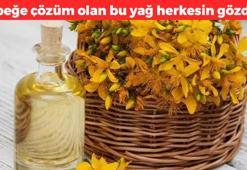Kepek sorununa kesin çözüm! Saçları parıl parıl parlatıyor, saç köklerini güçlendiriyor, saç dökülmesinden kurtarıyor