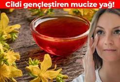 Kuru ve pul pul dökülen cildi toparlıyor! 1 gecede 5 yaş gençleştiriyor: Yanık ve yara izlerini geçiriyor