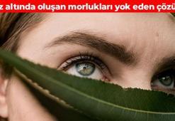 Yatmadan önce sürün! Kolajen üretimini artırıyor: Göz altı morluklarını silip süpürüyor