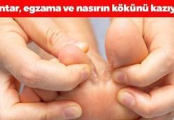 Mantarın kökünü kurutuyor! Egzama, nasır ve mantarı tarihe gömüyor, ayakları pamuk gibi yumuşacık ve pürüzsüz yapıyor!