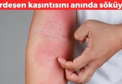 Kurdeşenin kökünü kurutuyor! 1 damlası kaşıntıyı söküp atıyor, 5 dakikada etki eden mucize kurdeşen kremi