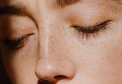 'Kışa girmeden benlerinizi muhakkak kontrol ettirin'