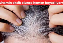 Beyaz saçların suçlusu bu eksiklikmiş! Bu vitamin eksikse saçlar hızla beyazlıyor: Çözümü görenler şaşkına dönüyor