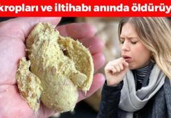 Sabah akşam 1 kaşığı öksürük, balgam ve hırıltının kökünü kazıyor! Doğal antibiyotik, iltihabı ve mikropları tarihe gömüyor!