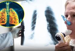 Her 10 kişiden 1'inde görülüyor! Tedavi edilmezse ölümle sonuçlanabiliyor: Sigara içmeyenler de risk altında