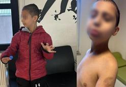 Özel bakım merkezinde otizmli 9 yaşındaki çocuğa şiddet iddiası