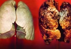 Her yıl  2.5 milyon insan yakalanıyor! Pasif içicilik bile riskini yüzde 30 yükseltiyor