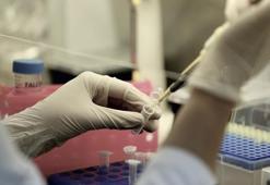 Bilim insanları açıkladı! O gen farklı hastalıklara neden oluyor